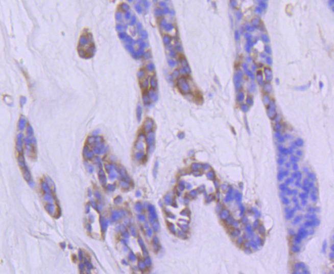 Anti-Phospho-PAK1/2/3 (Ser139) Antibody (4F435)