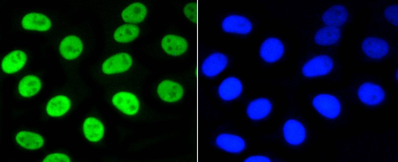Anti-Phospho-NFE2L2 (Ser40) Antibody (7L44)