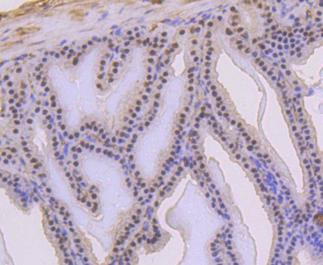 Anti-Phospho-p53 (Ser392) Antibody (2F452)