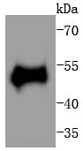 Anti-Phospho-p53 (Thr55) Antibody (1F203)