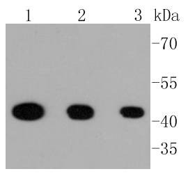 Anti-Phospho-MAP2K1 (Ser218, 222) Antibody (3S158)