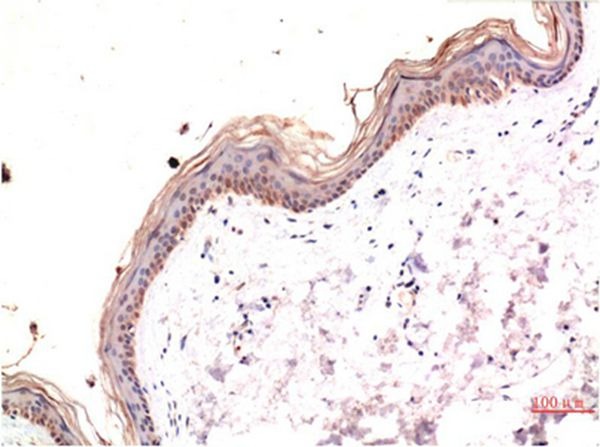 Anti-Phospho-MLKL (Ser358) Antibody (8A793)