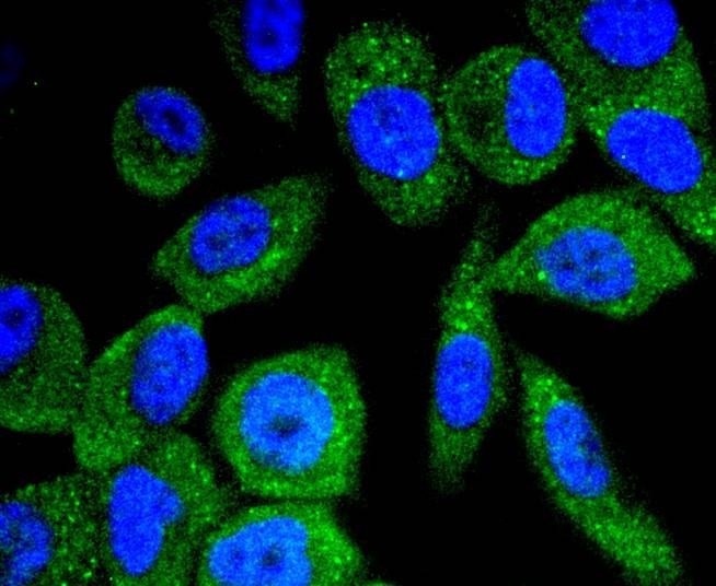 Anti-Phospho-BRAF (Thr401) Antibody (6W728)