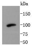 Anti-PI 3 Kinase Class 3 Antibody (2W658)