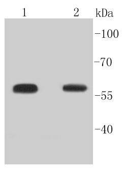 Anti-Phospho-SMAD5 (Ser463, 465) Antibody (2F385)