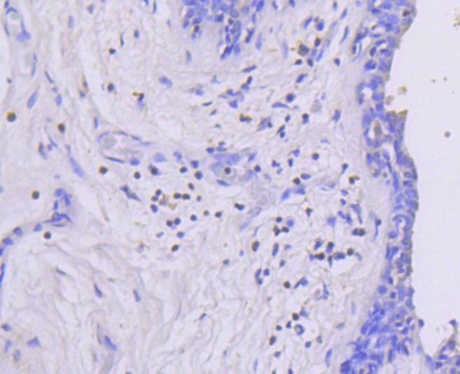 Anti-Phospho-MAP2K1 (Ser218, 222) Antibody (3S158)