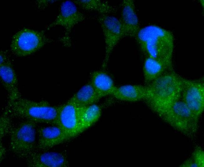 Anti-Phospho-PRKAA2 (Ser345) Antibody (4R913)