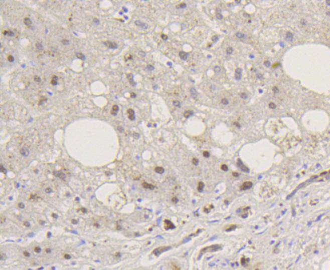 Anti-Phospho-SMAD5 (Ser463, 465) Antibody (2F385)