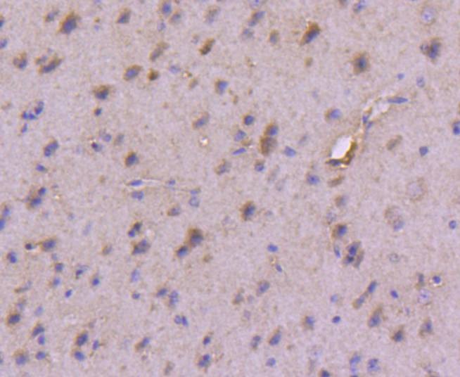 Anti-PI 3 Kinase Class 3 Antibody (2W658)