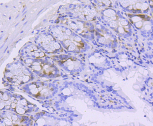 Anti-Phospho-CDK2 (Tyr15) Antibody (3L907)