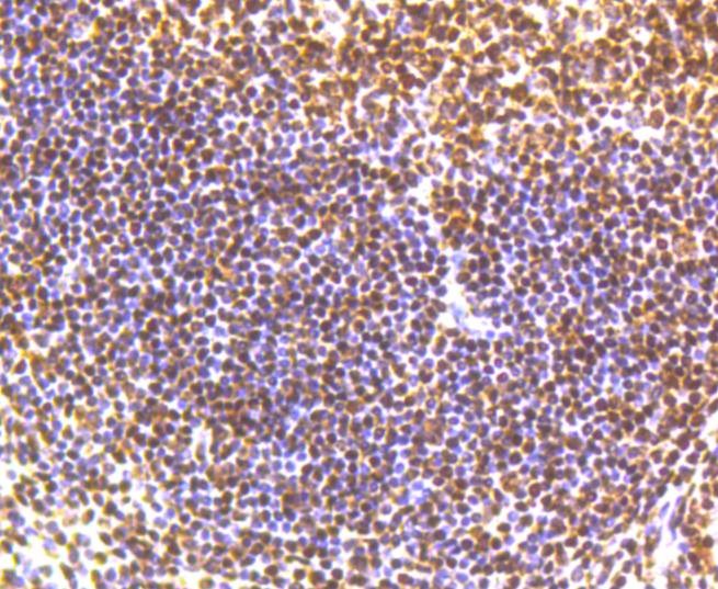 Anti-Phospho-SMC1A (Ser957) Antibody (1H28)