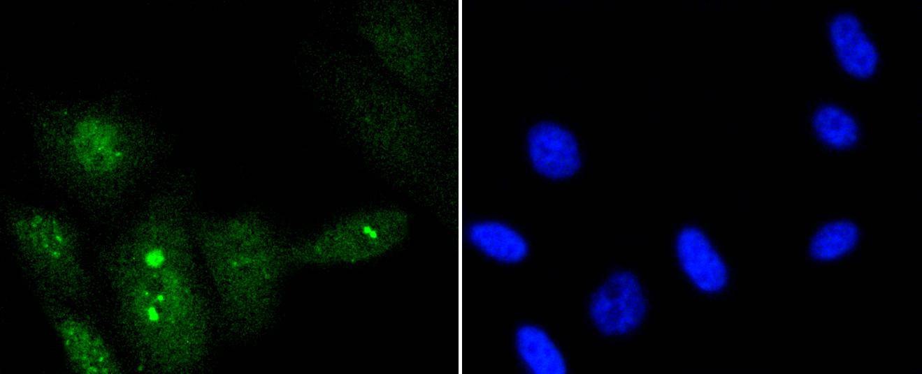 Anti-Phospho-NBN (Ser343) Antibody (5K712)