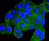 Anti-Phospho-AMPKα (Ser496) Antibody (3X970)