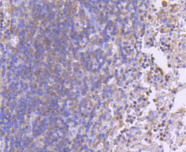 Anti-Phospho-MAP2K1 (Ser218, 222) Antibody (3S158)
