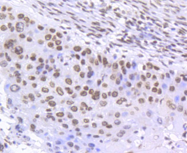 Anti-Phospho-SMC1A (Ser957) Antibody (1H28)