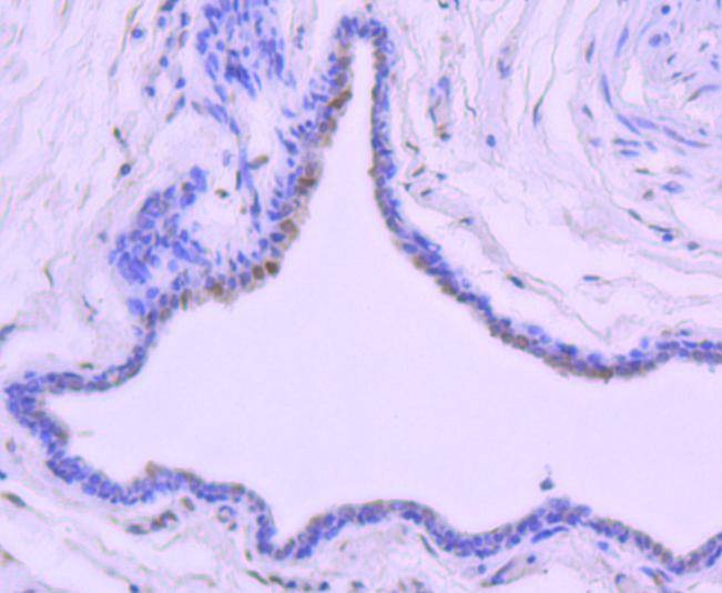 Anti-Phospho-JUN (Thr91) Antibody (2Q8)