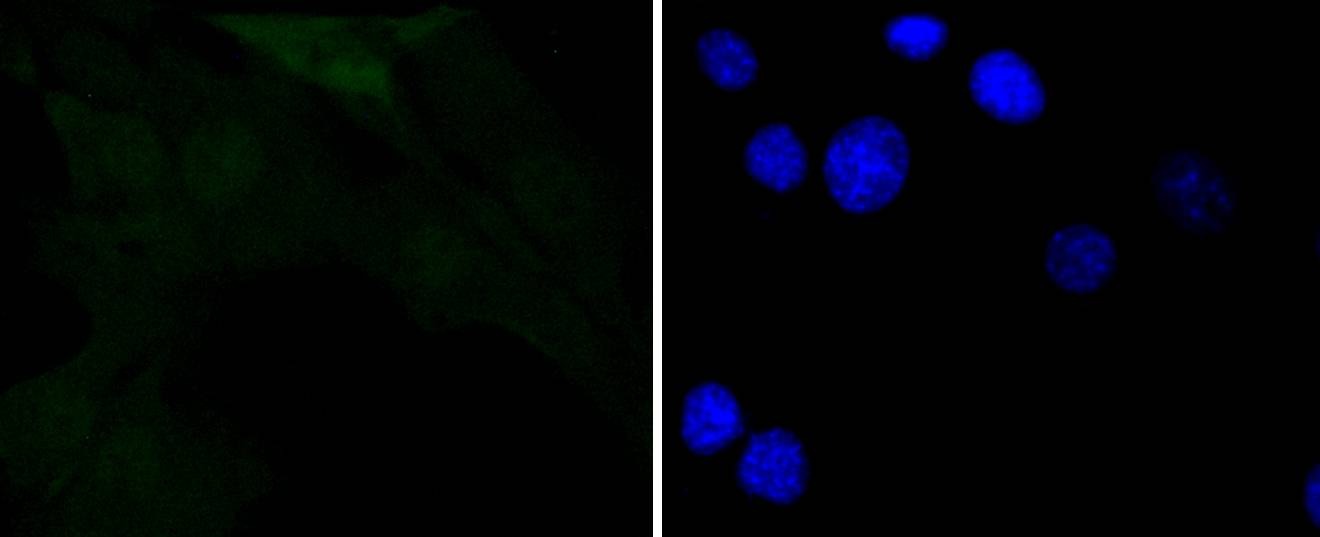 Anti-Phospho-NFKBIA (Ser32) Antibody (6R546)