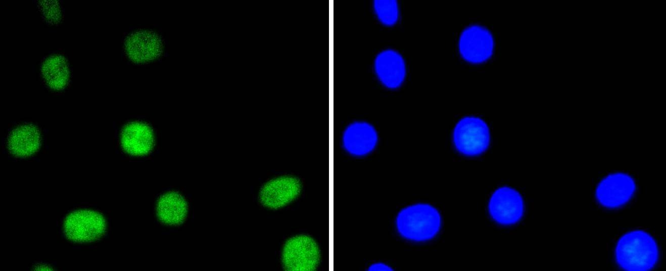 Anti-Phospho-ATF2 (Thr71) Antibody (3X852)