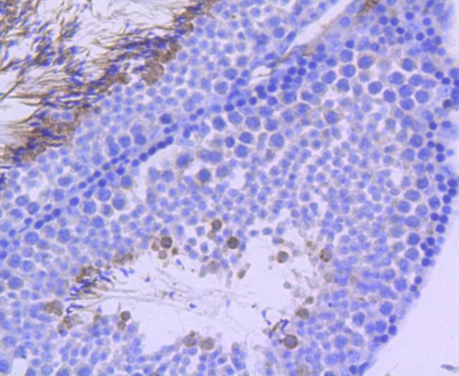 Anti-Phospho-NBN (Ser343) Antibody (5K712)
