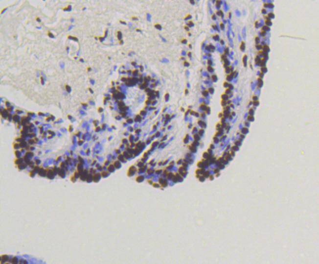 Anti-Phospho-SMAD5 (Ser463, 465) Antibody (2F385)