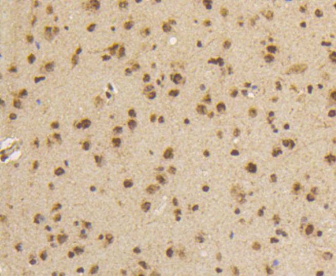 Anti-Phospho-SMAD5 (Ser463, 465) Antibody (2F385)