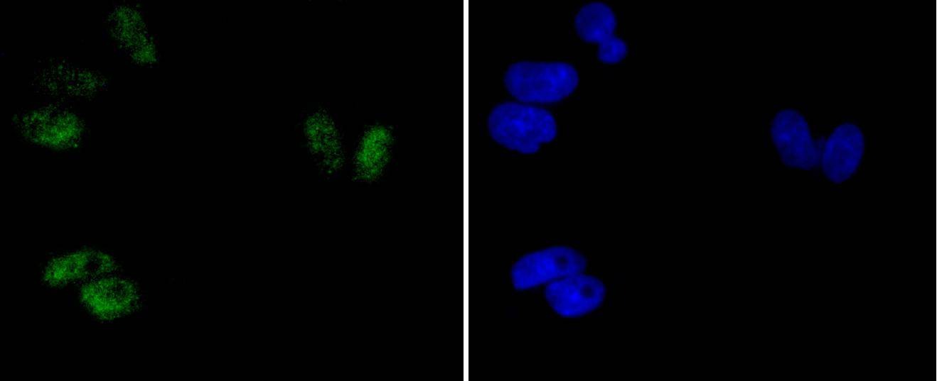 Anti-Phospho-ATF2 (Thr71) Antibody (3X852)