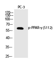 Anti-Phospho-PPAR gamma/PPARG (Ser112) Polyclonal Antibody 2