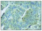 Anti-Phospho-EIF2AK2 (Thr446) Polyclonal Antibody 2