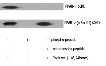 Anti-Phospho-PPAR gamma/PPARG (Ser112) Polyclonal Antibody 2