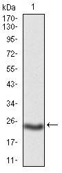 Anti-PKHD1 Antibody (4M854)