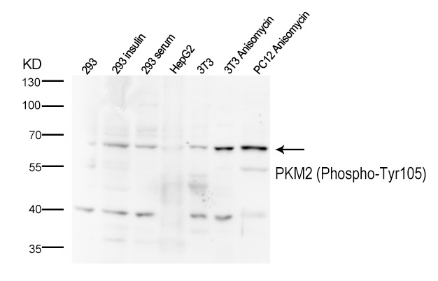 Anti-Phospho-PKM (Tyr105) Polyclonal Antibody