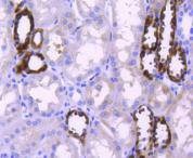 Anti-PPP1R1A Antibody (4O879)