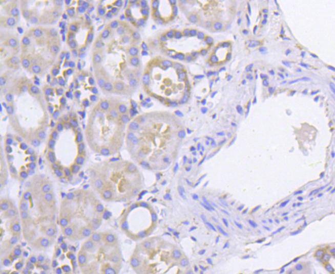 Anti-EIF2AK2 Antibody (3D60)