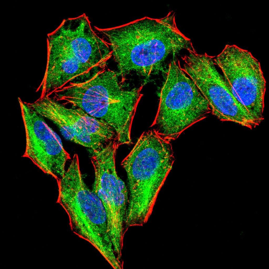 Anti-PKN1 Antibody (9Q867)