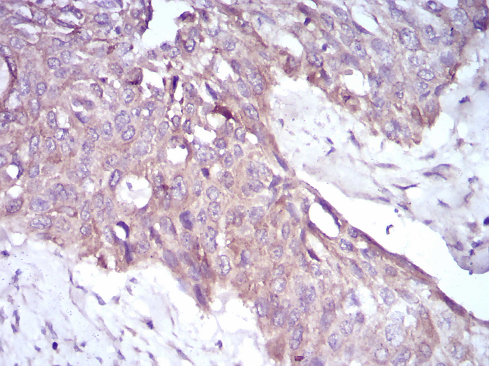 Anti-PKHD1 Antibody (4M854)