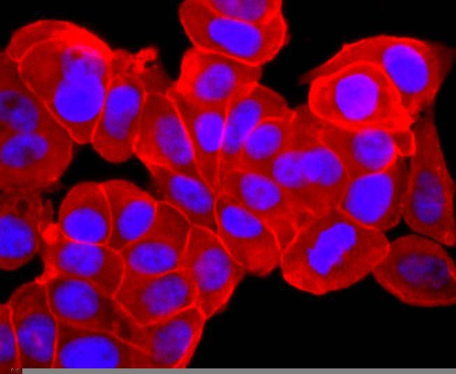 Anti-NRAS Antibody (5T588)