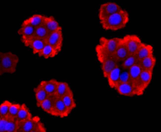 Anti-NRAS Antibody (5T588)