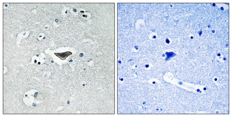 Anti-Phospho-Ras-GRF1 (Ser916) Polyclonal Antibody