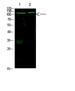 Anti-Acetyl-RB1 (Lys873, 874) Polyclonal Antibody