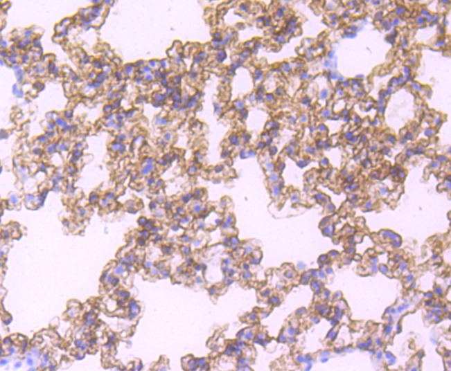 Anti-RAGE Antibody (3H335)