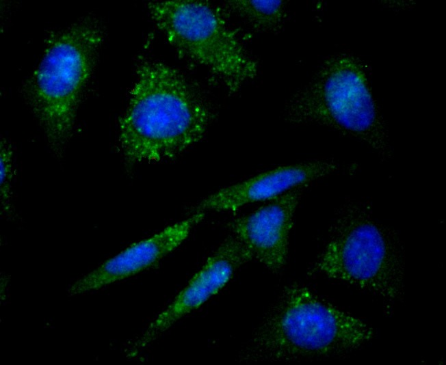 Anti-Protein Kinase D2/PRKD2 Antibody (5O381)