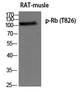 Anti-Phospho-RB1 (Thr826) Polyclonal Antibody 2