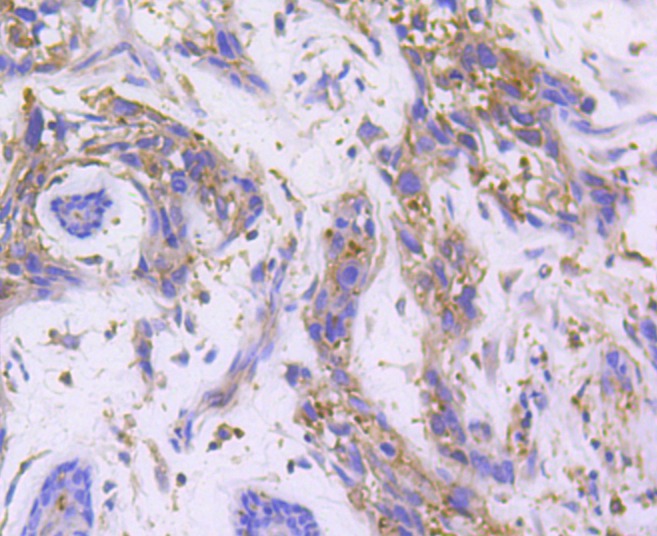 Anti-RALBP1 Antibody (4R123)