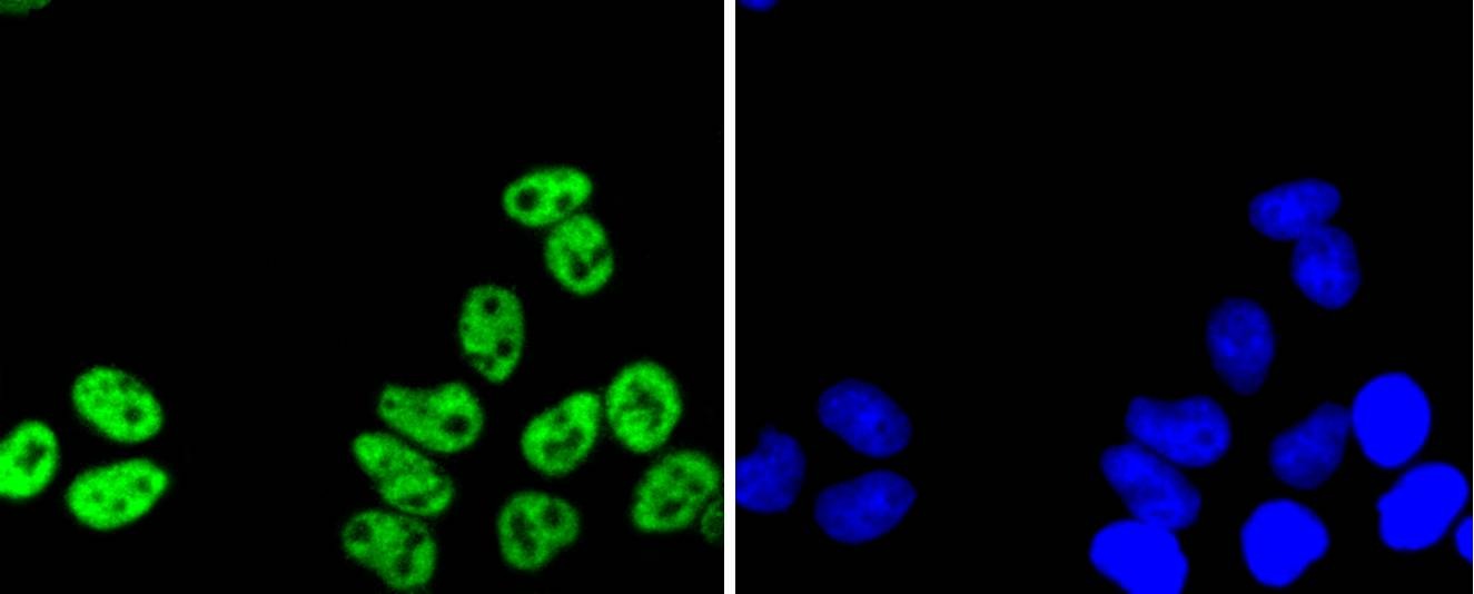 Anti-PRP19 Antibody (7U313)