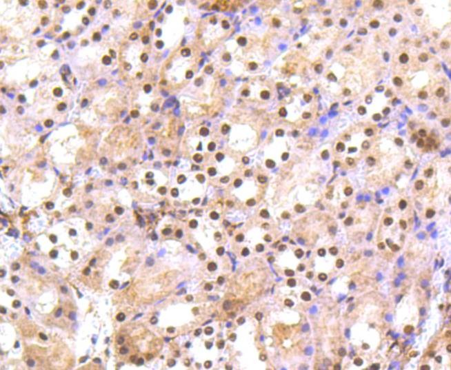 Anti-PRP19 Antibody (7U313)