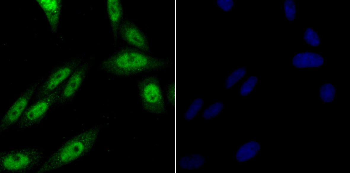 Anti-PRPF8 Antibody (4V102)