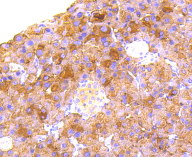 Anti-RALBP1 Antibody (4R123)