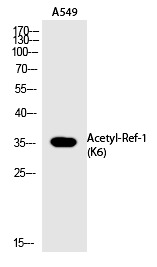 Anti-Acetyl-APE (Lys6) Polyclonal Antibody