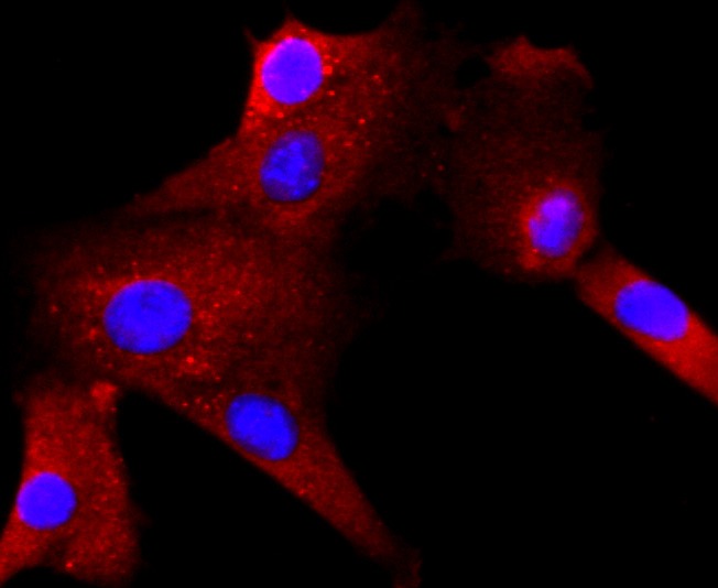 Anti-RAC1/2/3 Antibody (1M237)