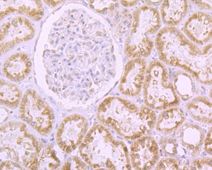 Anti-RanGAP1 Antibody (8X592)